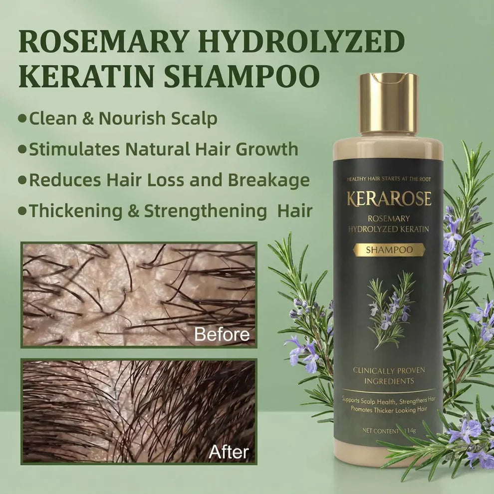 Kerarose Rosemary Shampoo For Hair Growth..