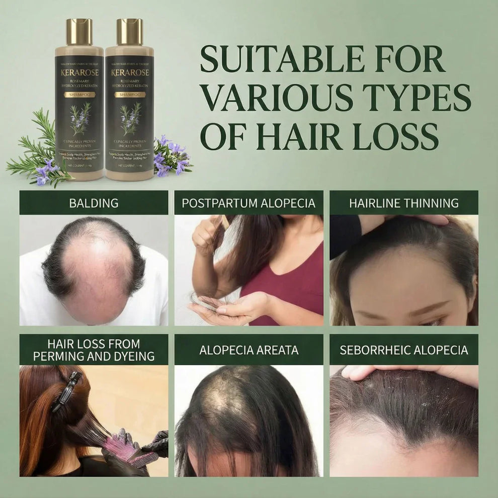 Kerarose Rosemary Shampoo For Hair Growth..